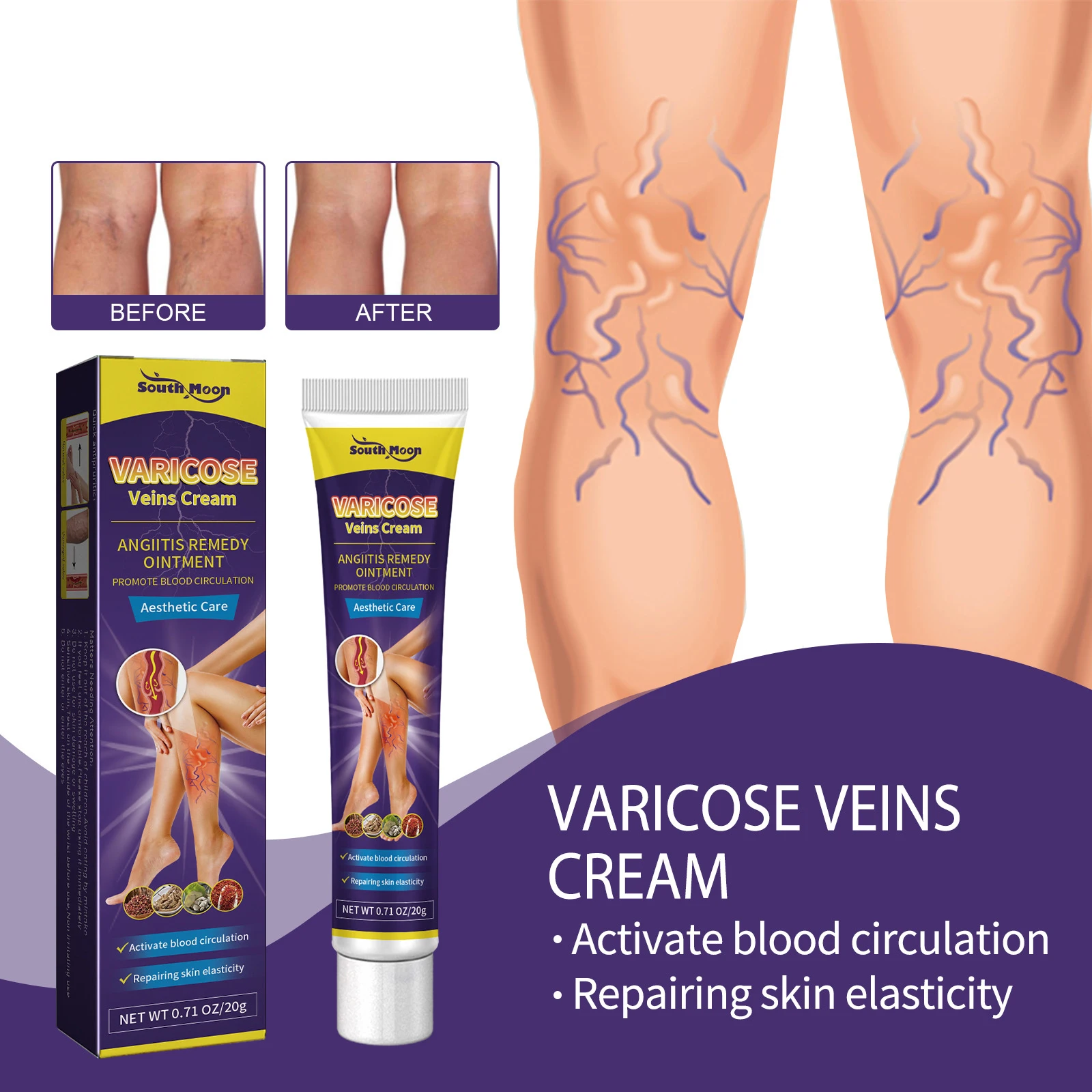 

Cream To Remove Varicose Veins Vital Gel For Ointment Against Feet The Legs Treatment Remedy Repair