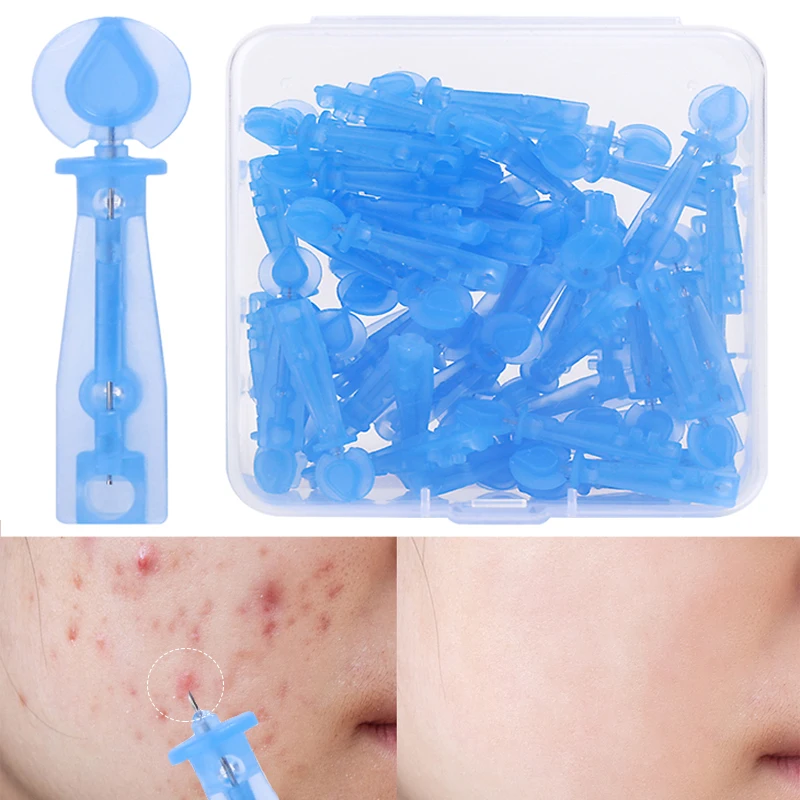 Одноразовые иглы из нержавеющей для удаления угрей акне очиститель в черный