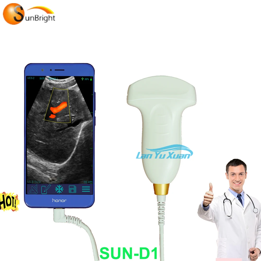 

USG wifi production USB ultrasound probe wireless with color doppler image mode