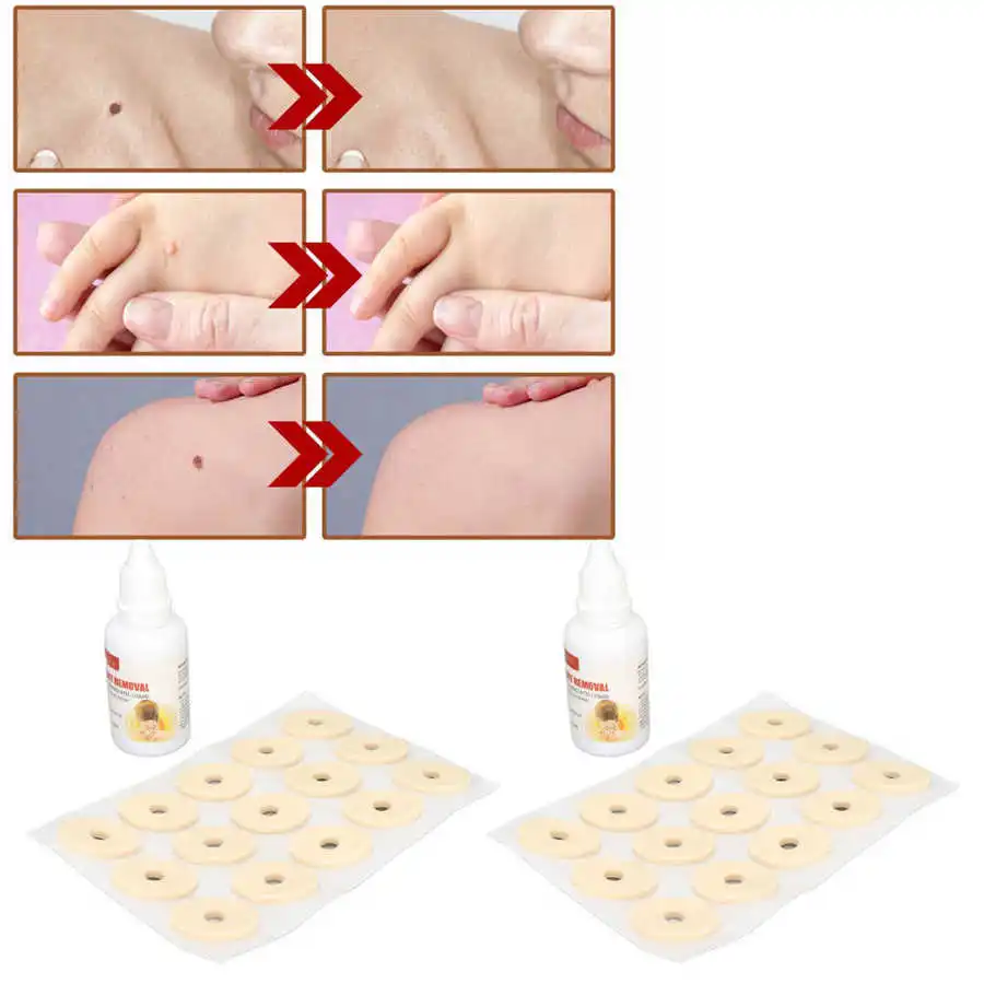 

Wart Remover Pads Form Conservation Layer Tag Remover Patches for Clean Skin