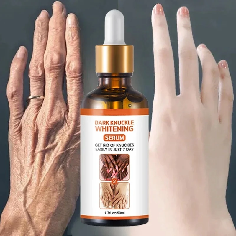 Отбеливающая сыворотка осветляет суставы пальцы локти колени улучшает кожу тела