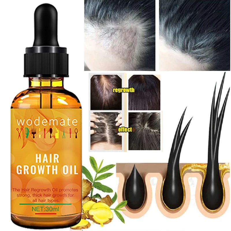 Имбирная Сыворотка для роста волос, эфирное масло против выпадения волос, масло для роста волос, эфирное масло для лечения красоты и здоровь...