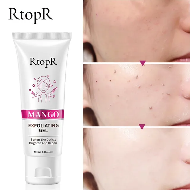 RtopR Facial Exfoliating Gel Cream Whitening Moisturizing Facial Scrub Clear Acne Blackhead Facial Scrub 4