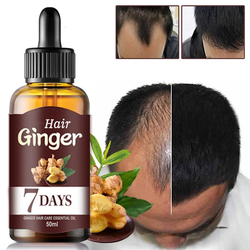 

Fast Hair Growth Serum Essential Oils Ginger Treatment Hair Loss Essence 7 Days Nourishing Soften Scalp Repair Damaged Hair Care