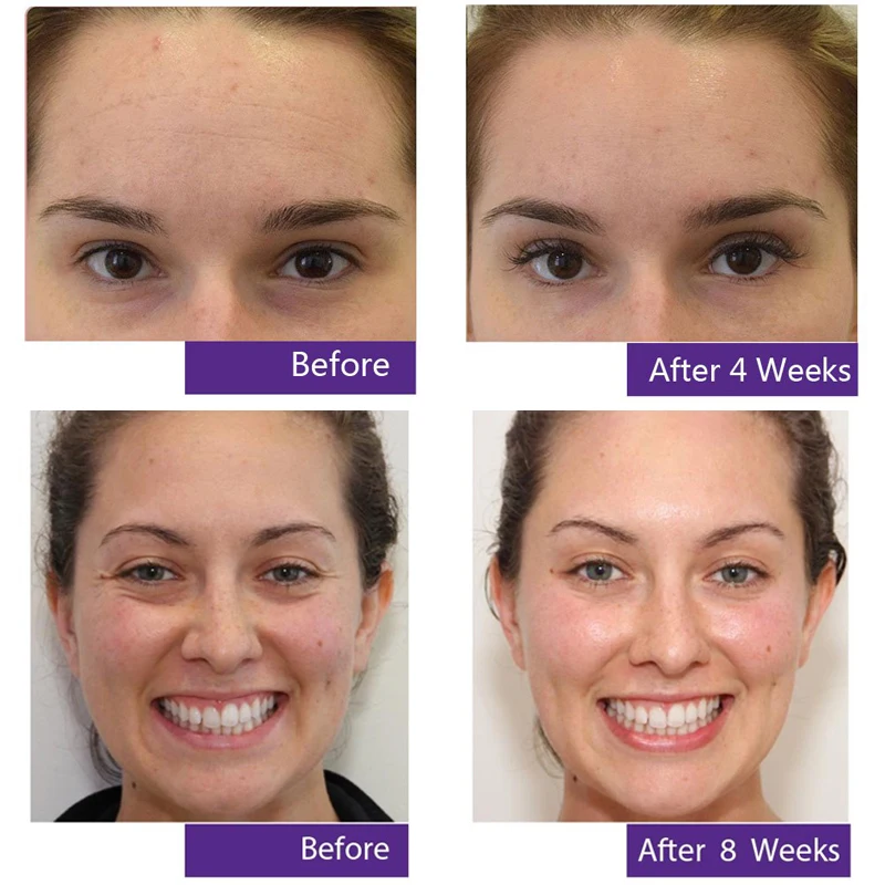 2% гидроксипинаколон ретиноат биологическая камедь керамид антивозрастной