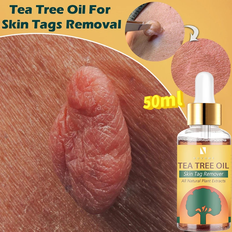 Three Scouts Organic Label Resolve Papilloma Serum Painless Mole Skin Dark Spot Remover Freckles Face Wart Label Remover Essenti