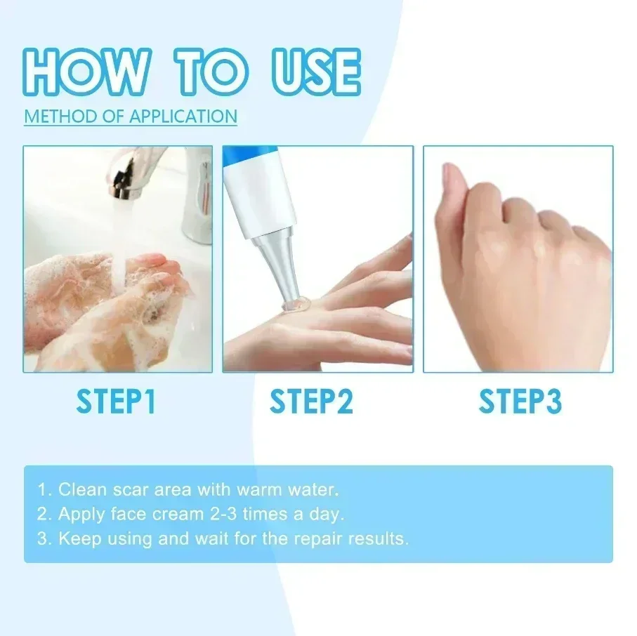 Лидер продаж удаление шрамов для беременных растяжек эффективное лечение