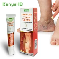 varicose veins cream for legs veins treatment relief inflammation vein varicosity angiitis removal herbal medical plaster care