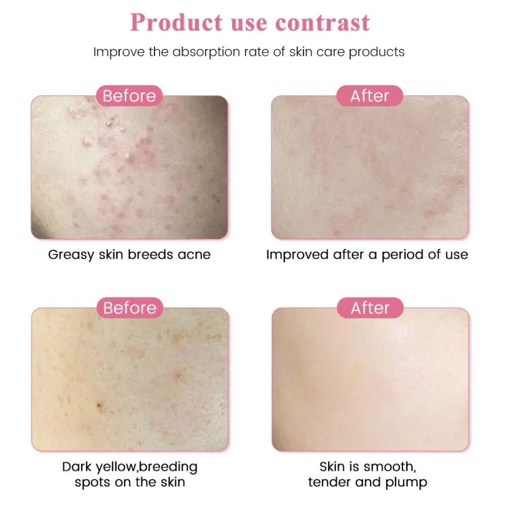 Рисунок 2 - Электрическая ручка для ухода за кожей