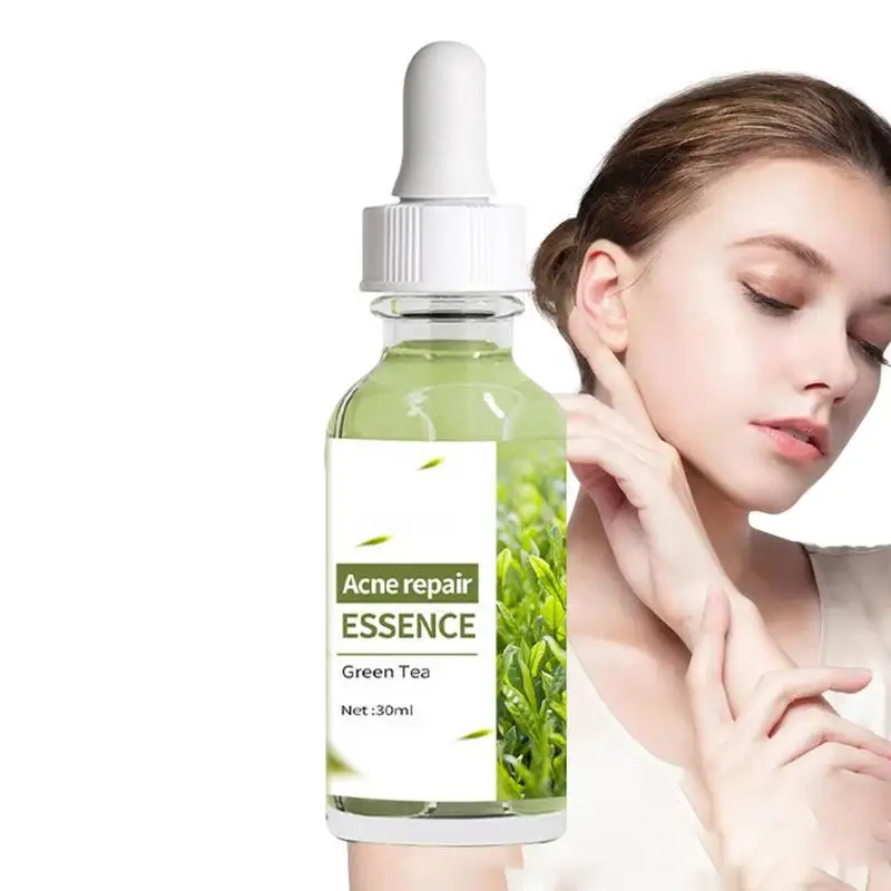 

Face Moisturizer For Pimples Green Tea Shrink Skin Pores Pimples Liquid 30ml Pimples Repair Beauty Firming Moisturizing Essence