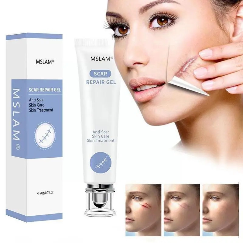 

20g Scar Repair Gel Removal Scar Acne Cream treatment Marks For Face Body Pigmentation Corrector Skin Care Cream J8D6