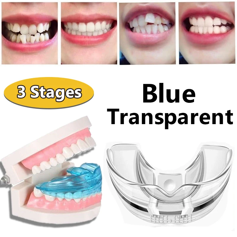 

3 Stages Dental Orthodontic Braces Teeth Retainer Bruxism Silicone Braces Appliance Guard Braces Tooth Tray Teeth Straightener