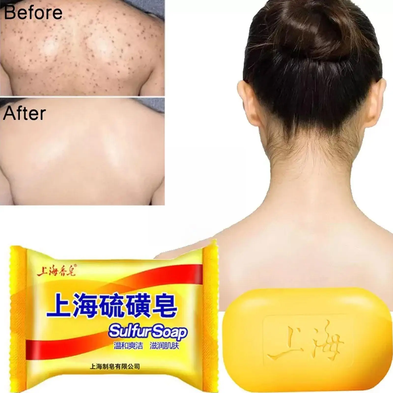 

Shanghai серное мыло для ванны, контроль жирности, акне, экземы, противогрибковое, недорогое Отбеливающее полезное Мыло для лица, экзема 85 P4G2