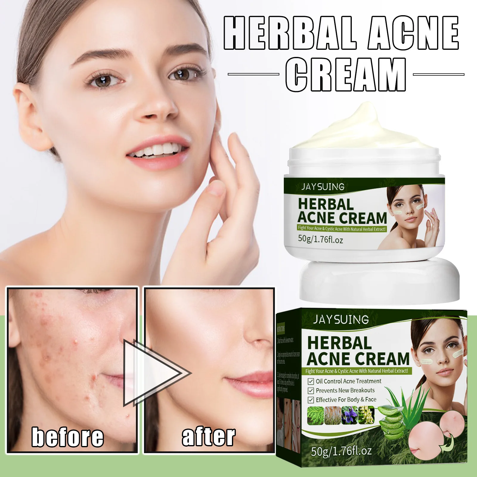 

Herbal Acne Removal Cream Treat Pimple Scar Oil Control Fade Spot Repair Whitening Anti-Aging Smooth Moisturize Facial Skin Care