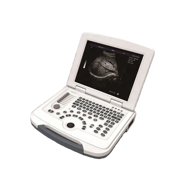 

BT-UD580 Cheap medical portable B/W ultrasound scanner ultrasound machine color doppler for pregnancy price