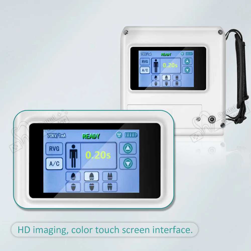 Рисунок 5 - Оригинальная рентгеновская камера