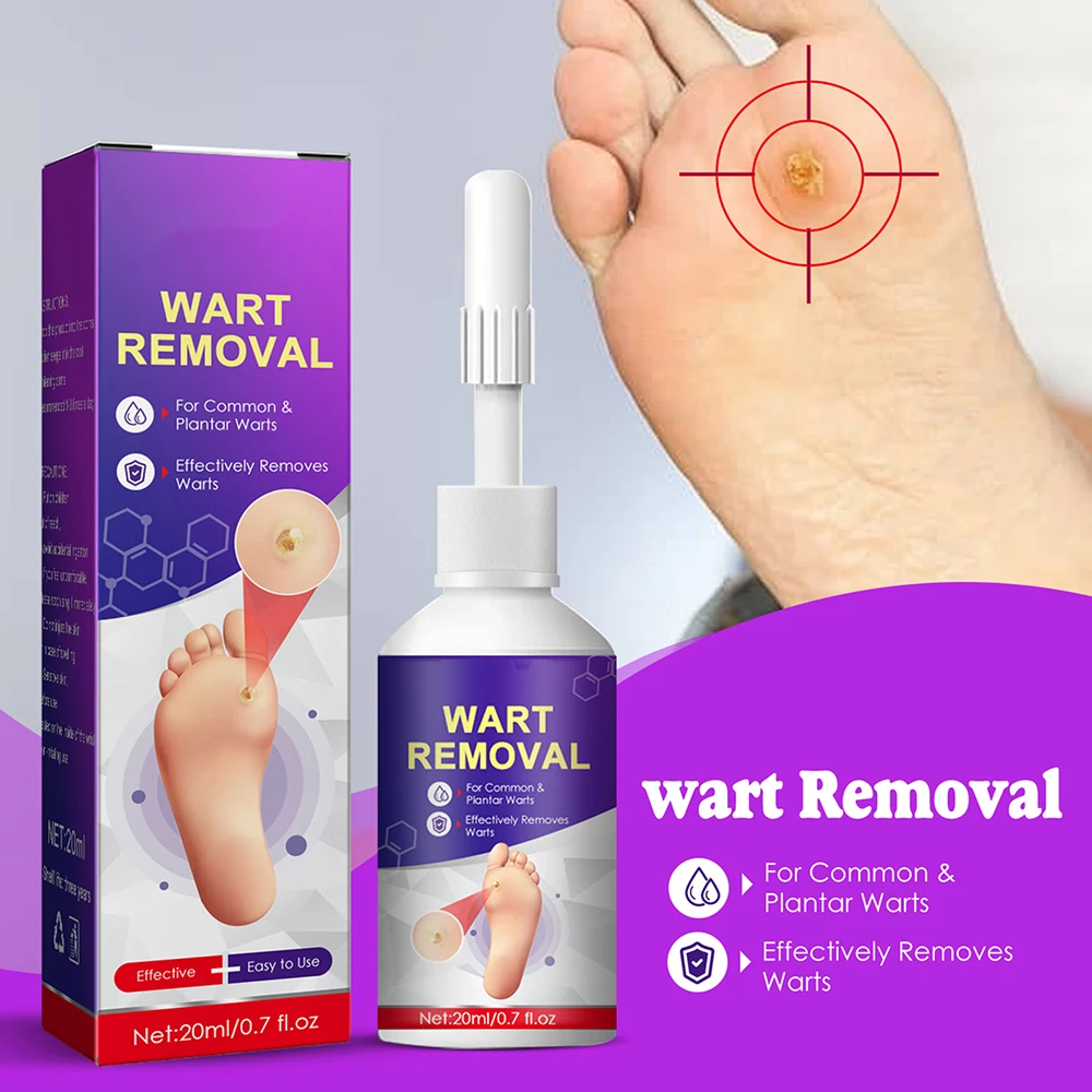 

20ml Corn Removal Liquids Body Warts Painless Remover Treatments Liquids For Face Neck And Body Wart Remover Skin Tag Remo