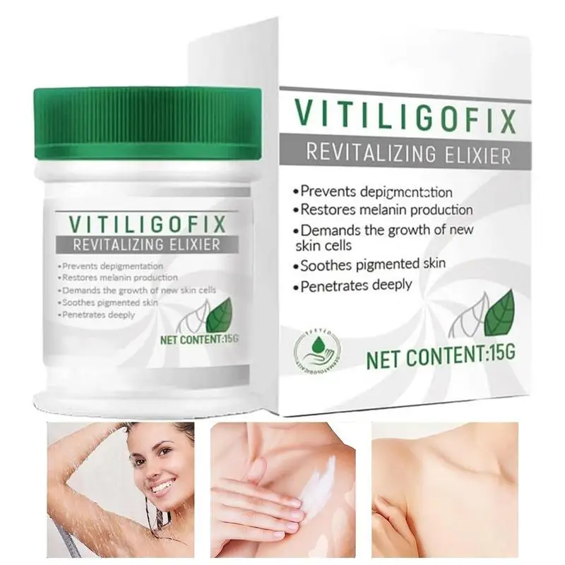 

White Spot Cream 15g White Spot Relief Cream Skin Care White Spot Removal Cream White Spot Ointment Eliminate Cream