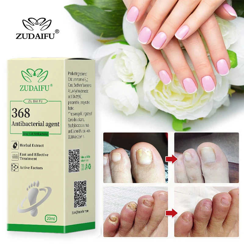 

ZUDAIFU 368 Nail Fungal Treatment Essence Anti Infection Paronychia Onychomycosis Repair Foot Nail Fungus Removal Feet Care 20ml