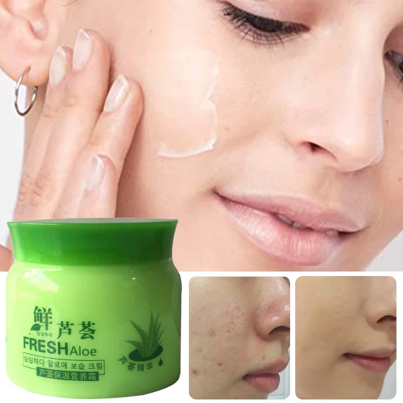 

80g Aloe Vera Cream Skin Care Anti-acne Post Sun Repair Fade Acne Marks Improve Rough Brighten Moisturizing Facial Treatment
