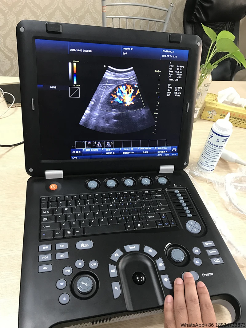 Sunbright Hospital Color Doppler Ecografo Портативный портативный ультразвуковой ультразвук для