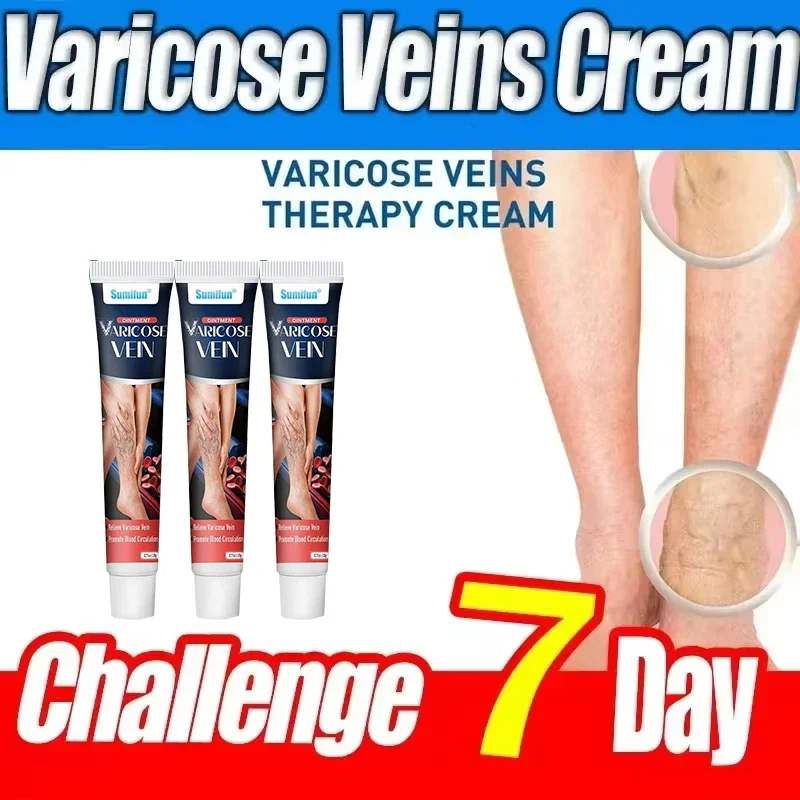 Ungüento для веджеров от варикозного расширения elmina la Vasculitis флеби венеры на основе