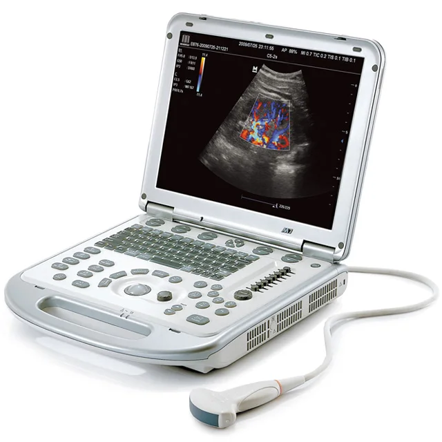M7 Mindray Professional Portable 3D/4D Color Doppler Ultrasound Machine, ecografo mindray m5 m7 m9