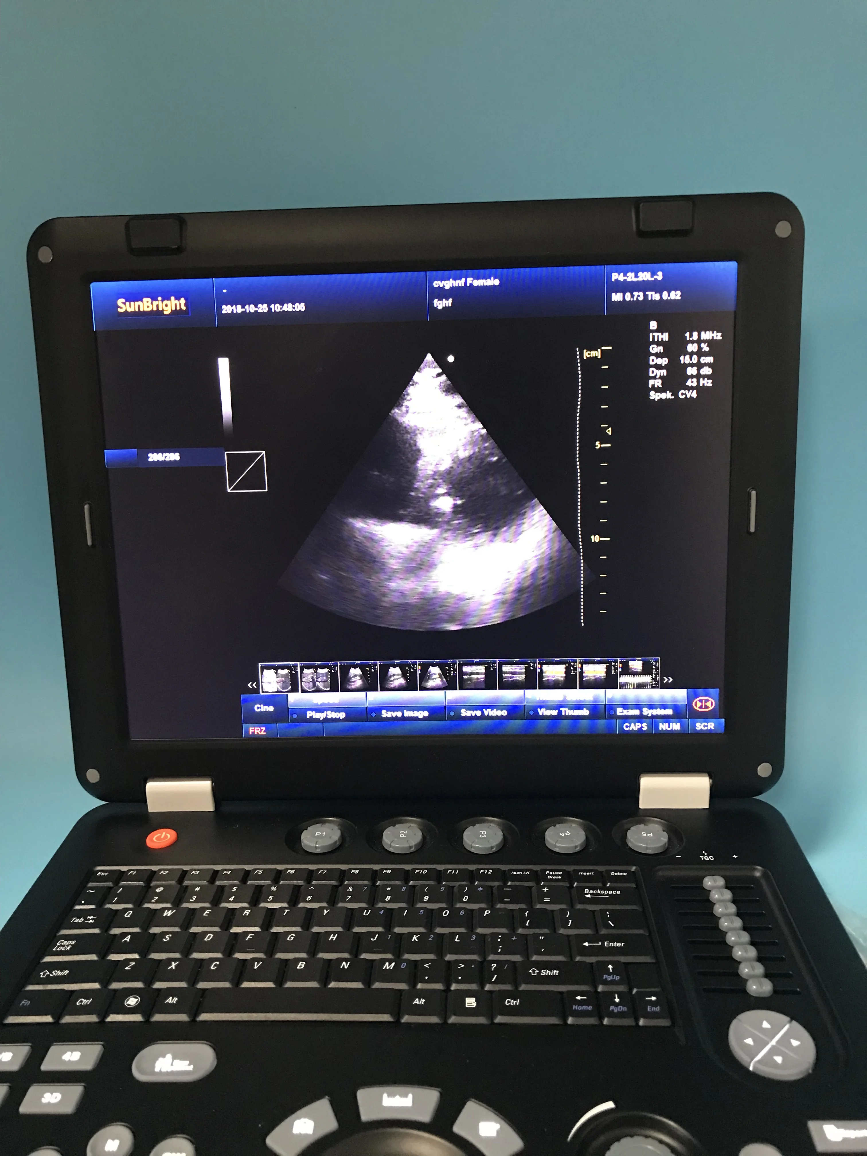 

High quality fetal doppler diagnostic 3D color doppler for cardiac vascular