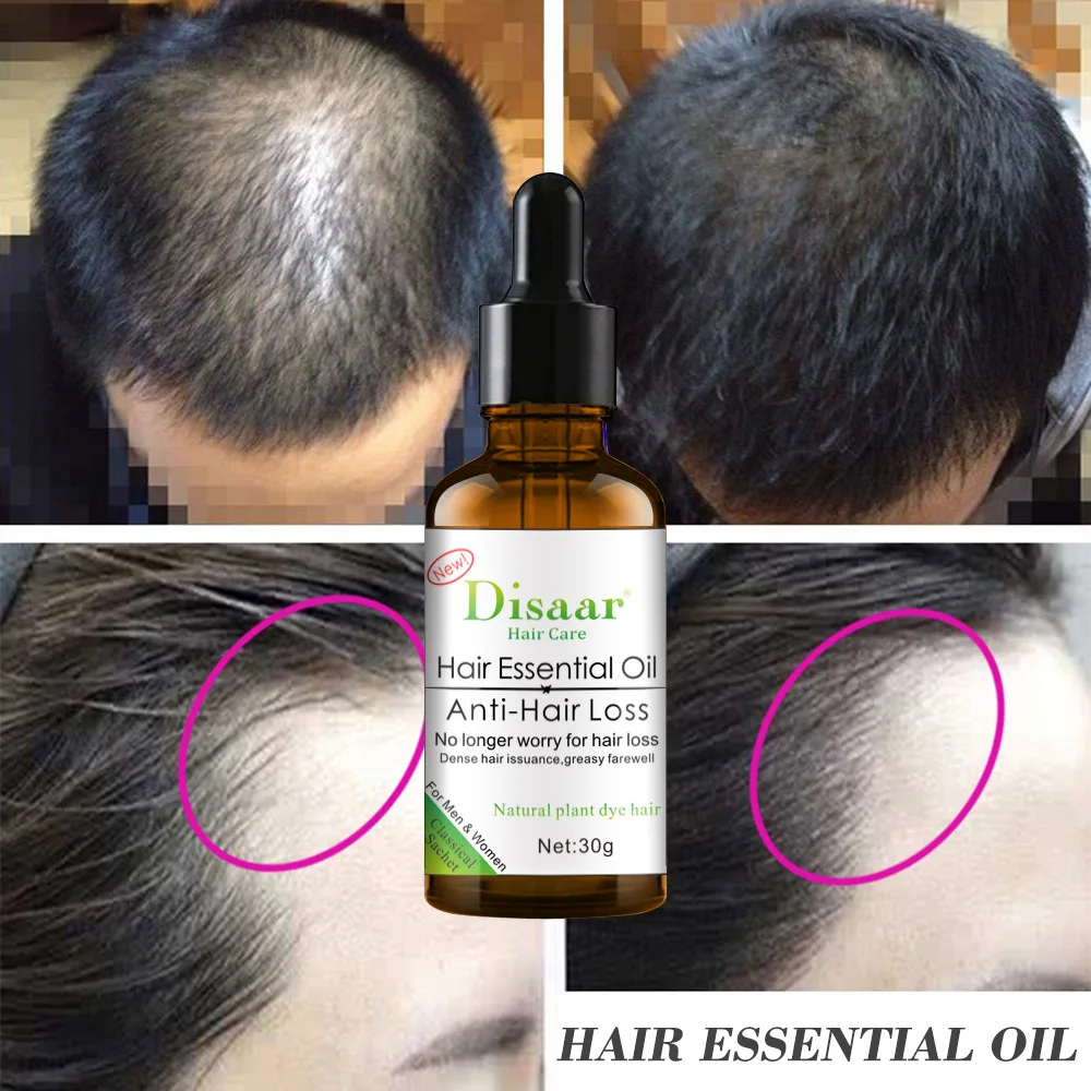 

Natural Plant Thick Hair Essential Oil Anti Hair Loss Head Massage Oils Essential Serum Hair Root Repairing Fast Growth Products