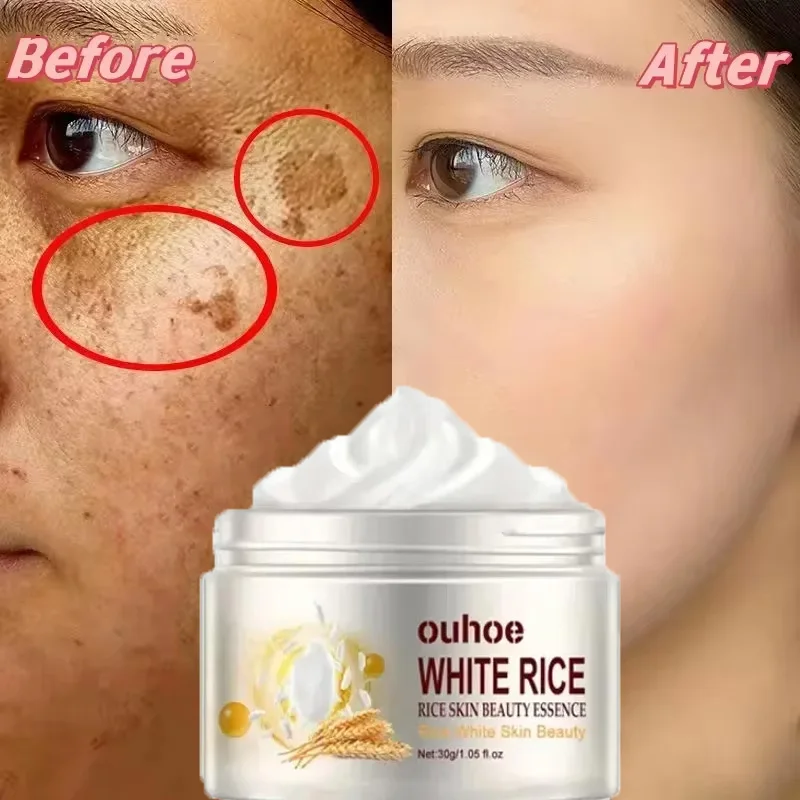 Отбеливающий крем для лица с белым рисом удаление темных пятен выцветание