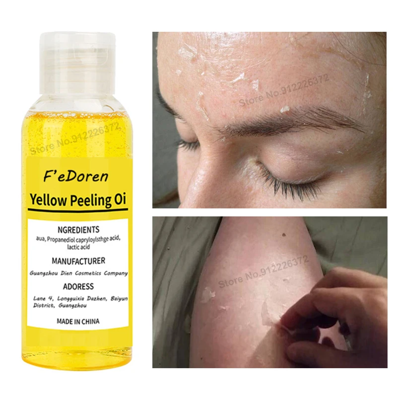 

30/50ml Body Yellow Peeling Oil Bleaching Dark Skin Retinol With Peptide Remove Spots Blackheads Skin Brightening Spot Treatment