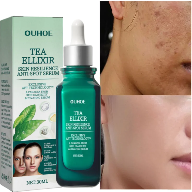 

Fast Whitening Freckle Serum Remove Dark Spots Melasma Melanin Correction Improve Skin Dullness Aanti-Aging Moisturize Brighten