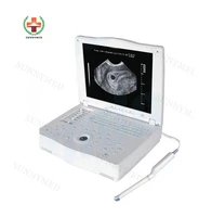 sy a004 full digital ultrasonic equipment bw usg portable laptop ultrasound