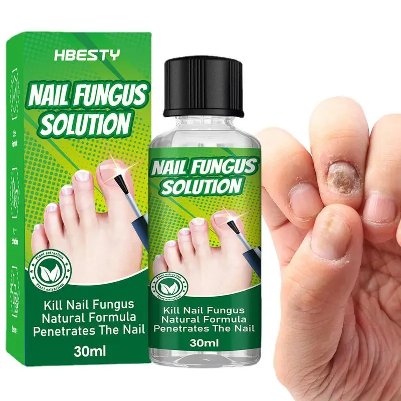 

Эссенция для восстановления ногтей, улучшающая ткань, восстанавливающее ломкое поврежденное масло для ногтей, 30 мл, портативная восстанавливающая эссенция для сужения ногтей