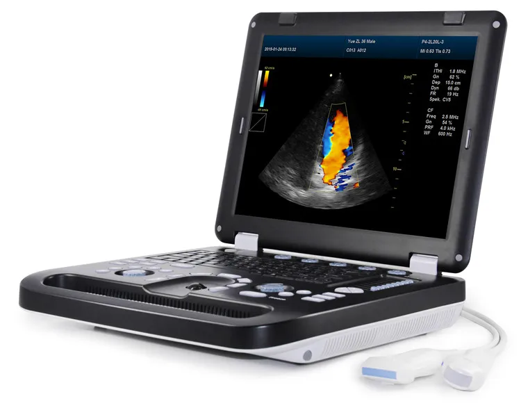 

Portable 3D 4D Echografo OB/GYN Ultrasound Machine Color Doppler Medical Ultrasound Instrument Price Ultrasonography Machine