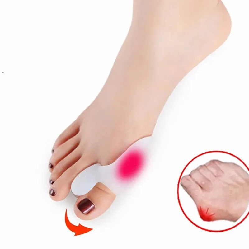 

20Pcs=10Pairs Big Toe Separator Bone Corrector Straightener Silicone Gel Fingers Protector Bunion Adjuster Foot Care Relief Pads