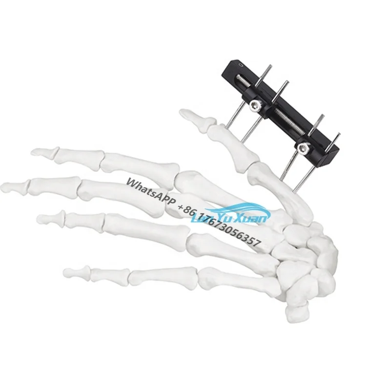 

External Fixator for Mini Fixator Straight Track Type