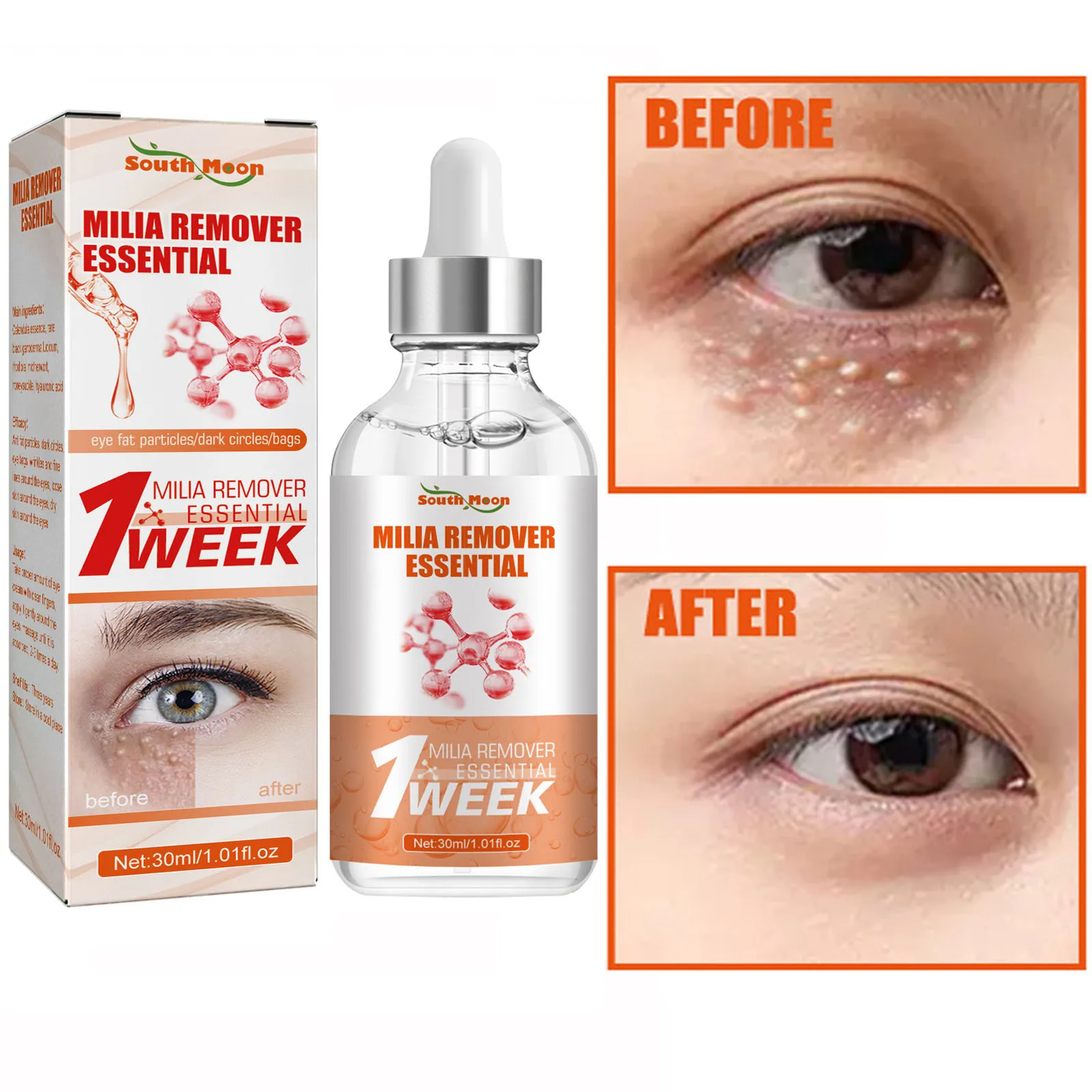 Milia Remover Serum Anti Dark Circle Eye bags Fat Granules Deep Clean Essence Anti-inflammatory Moisturizer Brighten Beauty Care