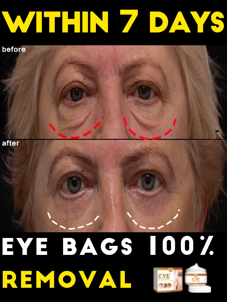 Исправить все проблемы с глазами