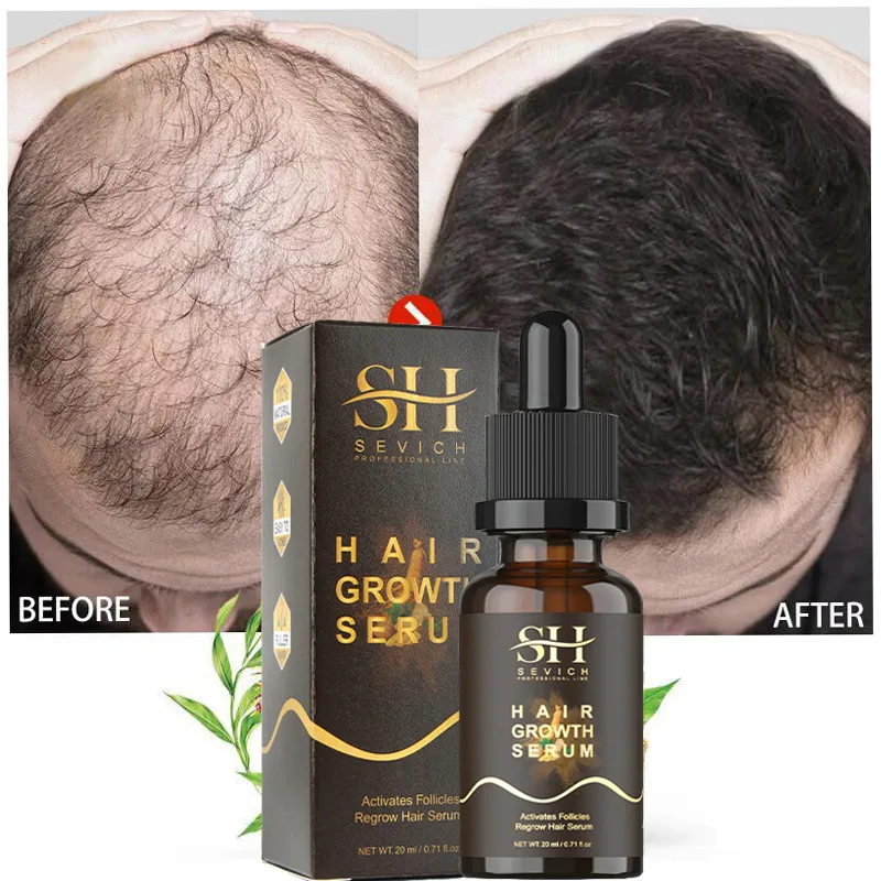 Instant Hair Growth Serum Hair Regrowth Serum Fast Growth Hair Essential Oil Anti-Hair Loss Scalp Treatment Hair Growth Product