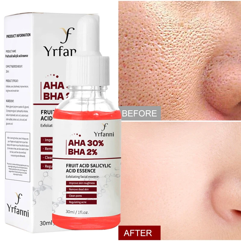 

Pore Shrinking Serum Repairs Large Pores Salicylic Acid Face Essence Anti-wrinkle Facial Serum Oil Control Whitening Skin Care