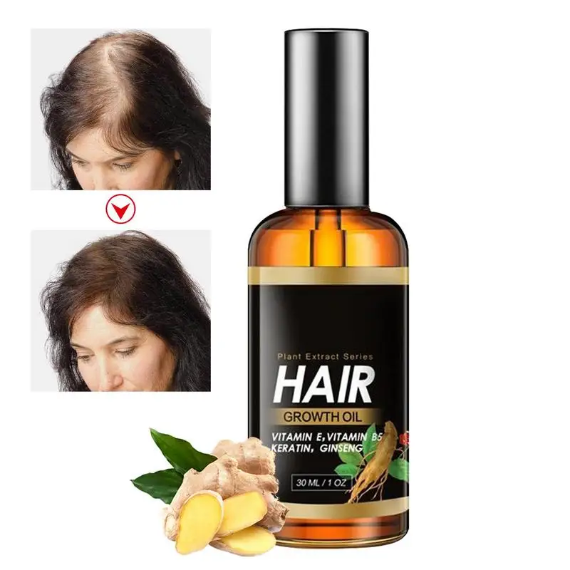 

Essential Oils For Hair Growth Thin Hair Strengthening Oil 1 Oz Deep Nourishing Hair Growth Treat For Split Ends Dry Scalp &