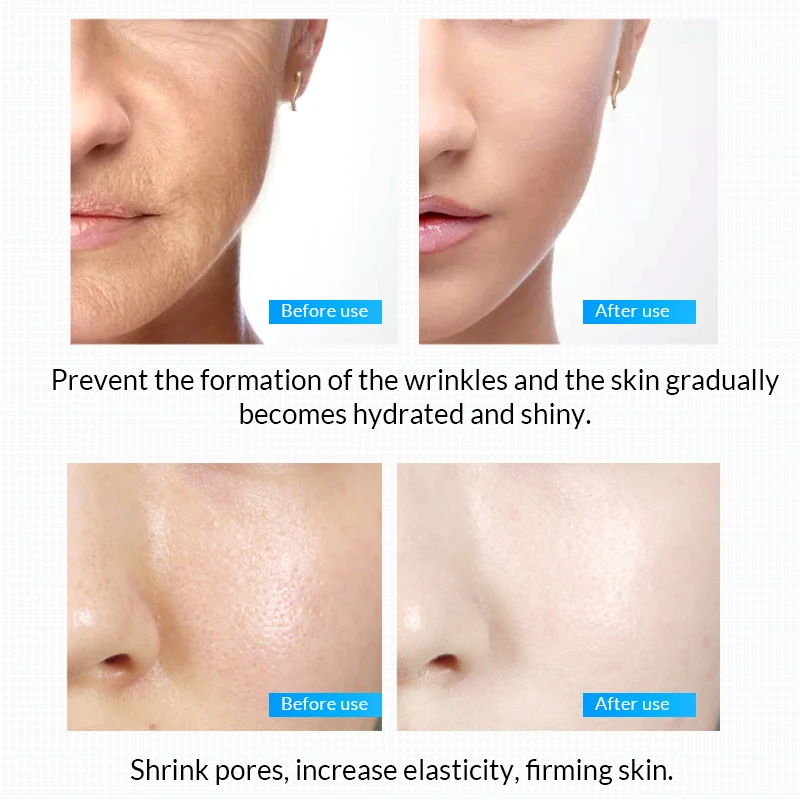 OMY LADY 10 шт. гиалуроновая кислота оригинальный раствор сыворотка для лица против