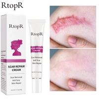 rtopr acne scar removal cream stretch marks remove acne spots burn surgical scars treatment gel smooth whitening body skin care