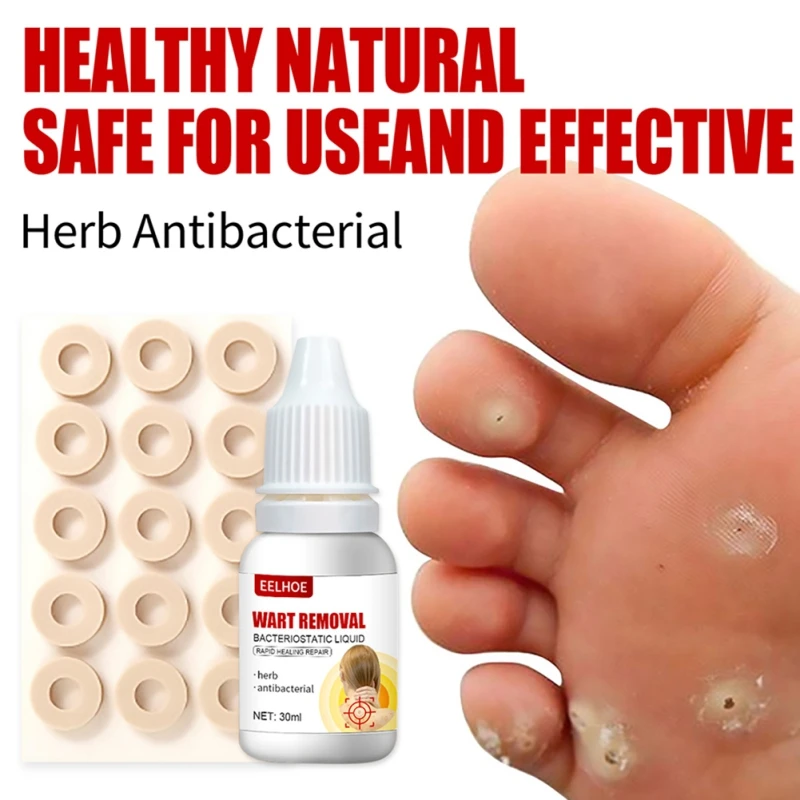 

30ml Wart Remover Kits Liquid Treatment Skin Tag Remover Moisturizing Reduces Friction Pain Relief Rapid Healing Repair Health