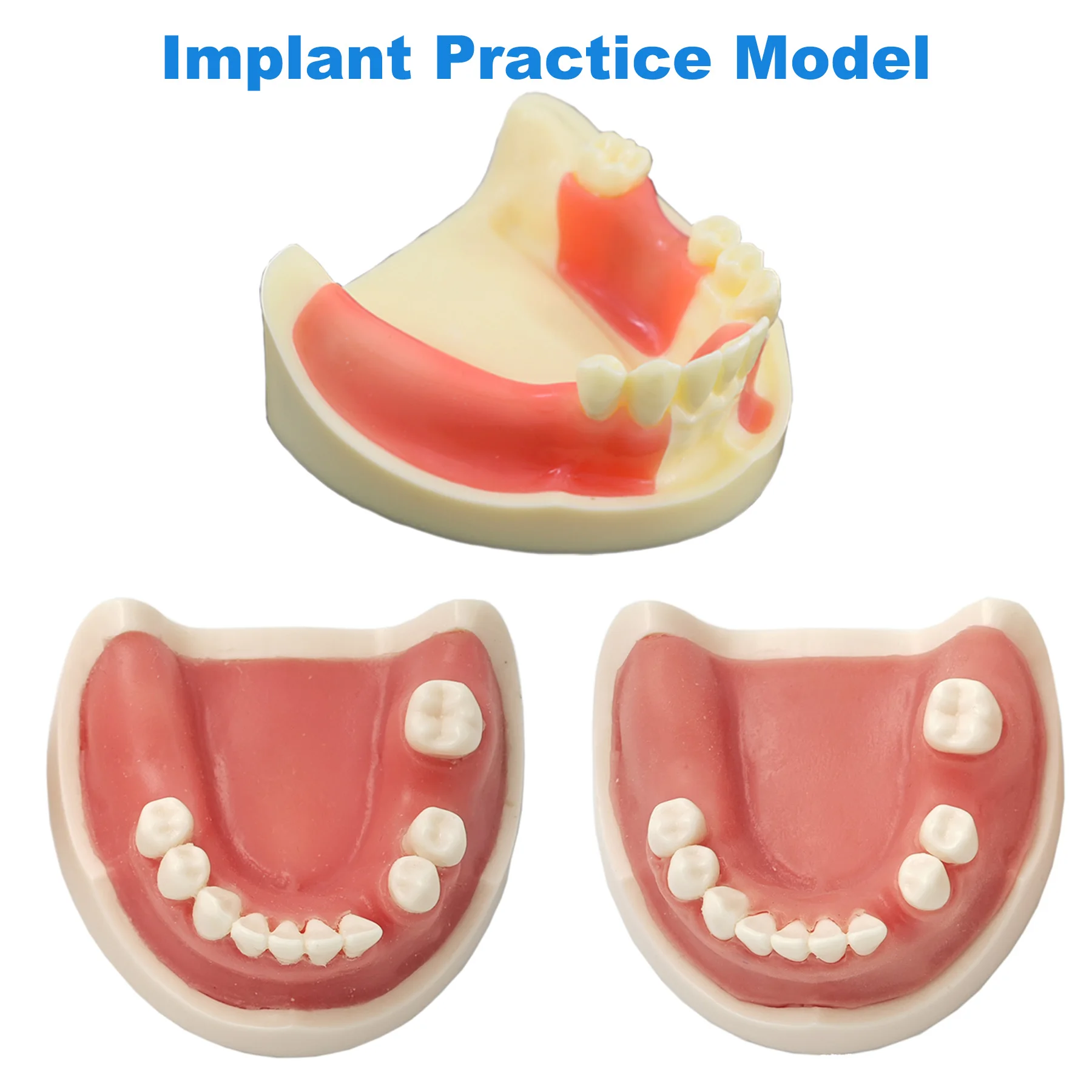 Модель зубного импланта модель для стоматологии тренировочный десен швы