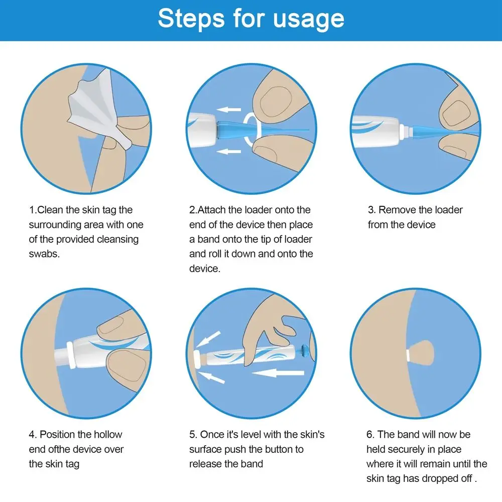 2 в 1 набор для удаления бородавок и |