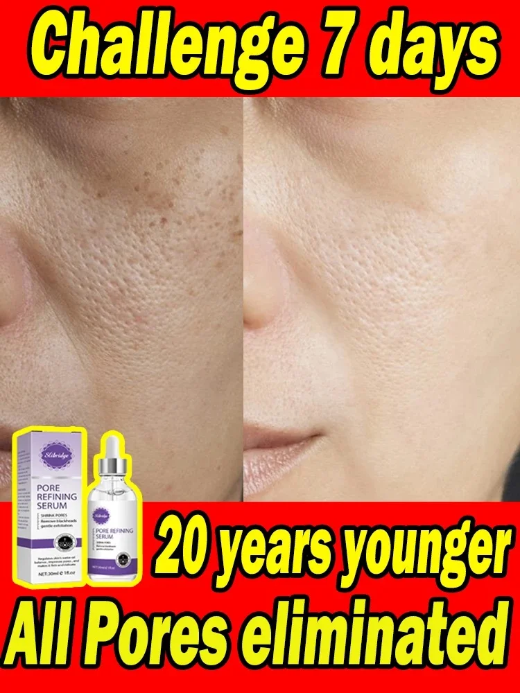 

Facial Pore Shrinking Serum Repair Remove Blackheads Acne Skin Care Facial Pore Shrinking Serum Wet Soothing Brightening Repair