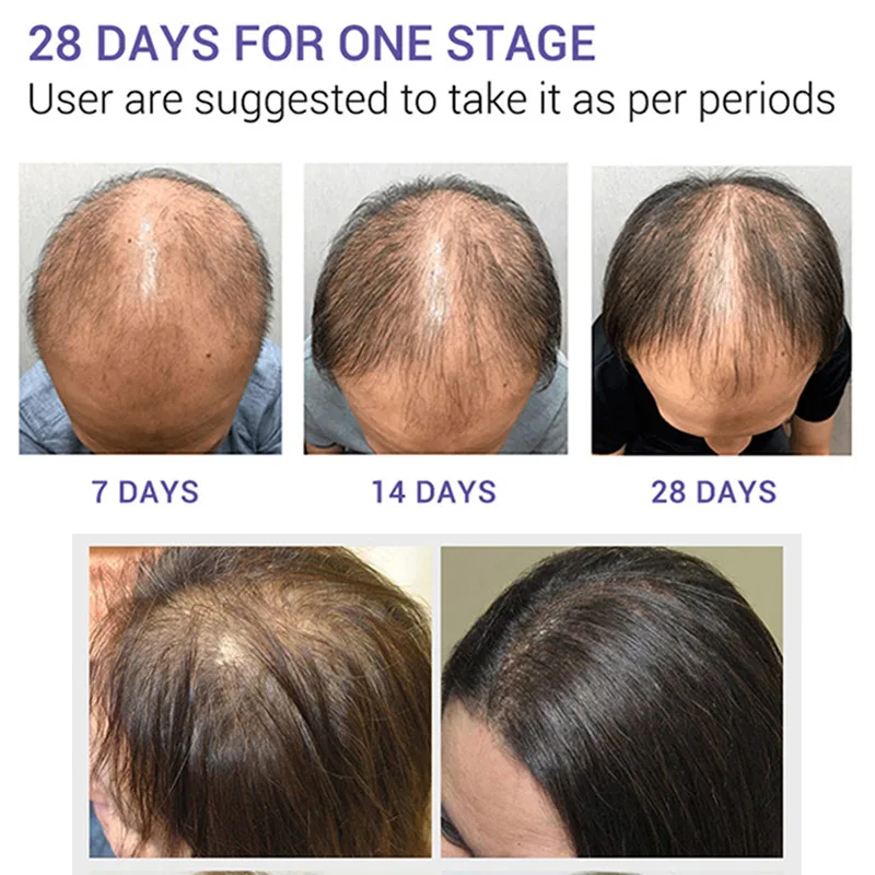 Эфирное масло для роста волос сыворотка быстро расти от потери уход поврежденных