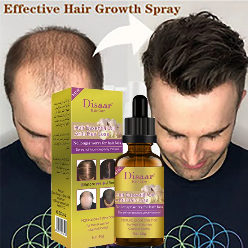 

Ginger Hair Growth Products Essence Oil Fast Hair Growing Anti Hair Loss Scalp Treatment Anti Preventing Hair Loss For Men Women